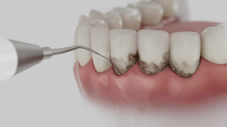 Trusted Dental Implants service in Shields, MI - Dentist Open Now